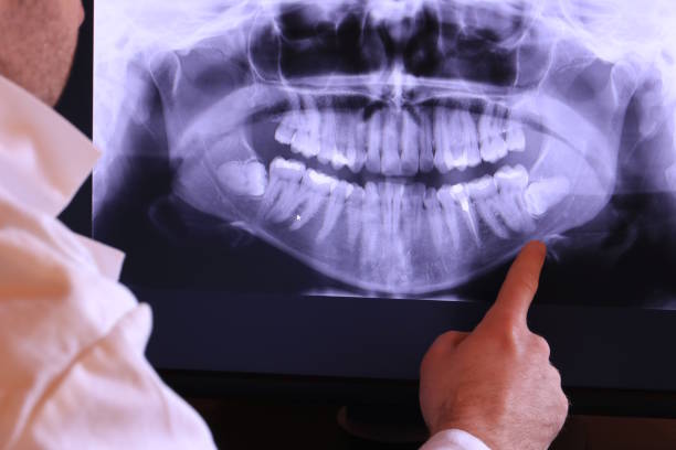 Best Pediatric Emergency Dentist in Whitemarsh Island, GA