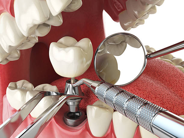 Best After-Hours Emergency Dentist in Whitemarsh Island, GA